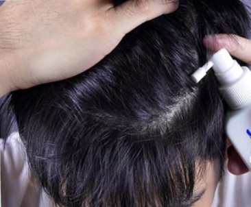 Hair Tonic แฮร์โทนิค 3