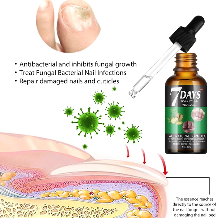 7 Days Nail Fungus Treatment 3