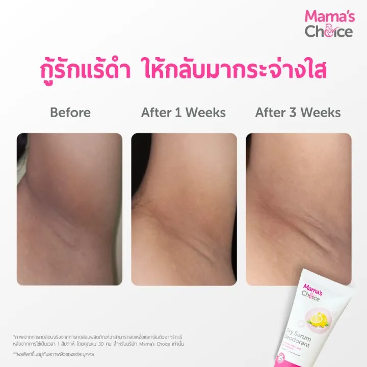  Dry Serum Deodorant เซรั่มระงับกลิ่นกาย 3
