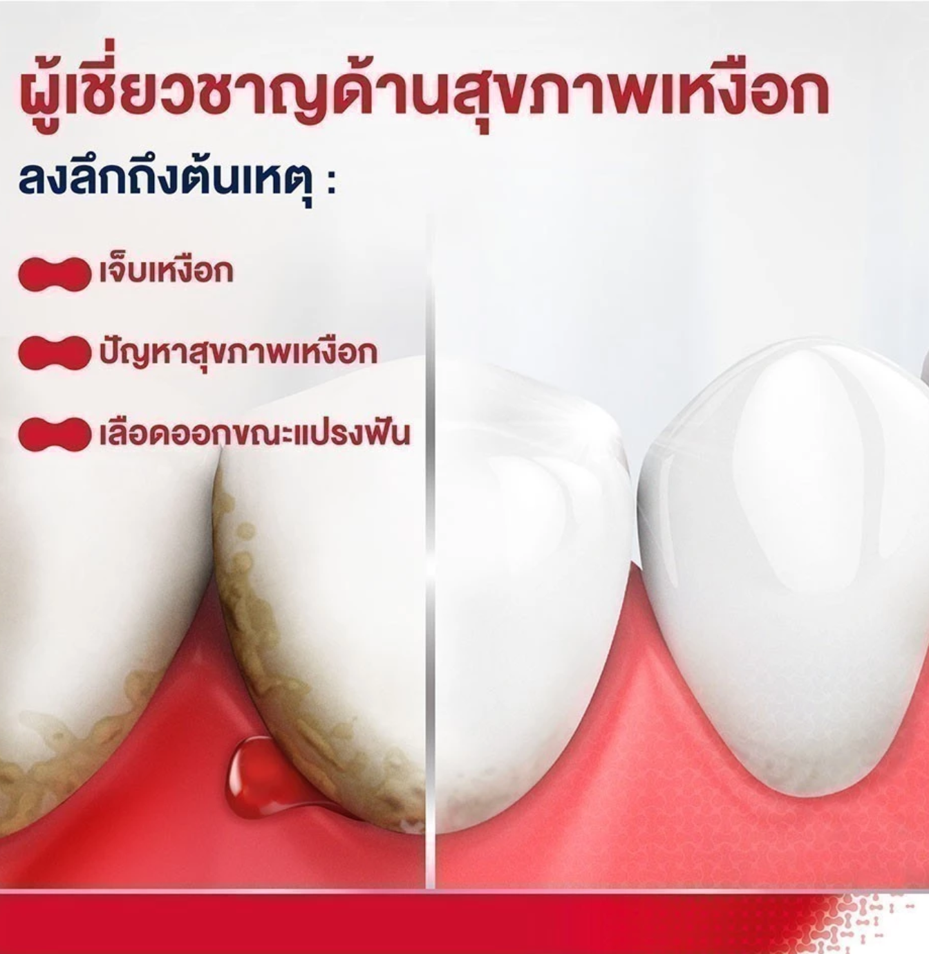ยาสีฟันที่มีฟลูออไรด์ Toothpaste Fluoride 3