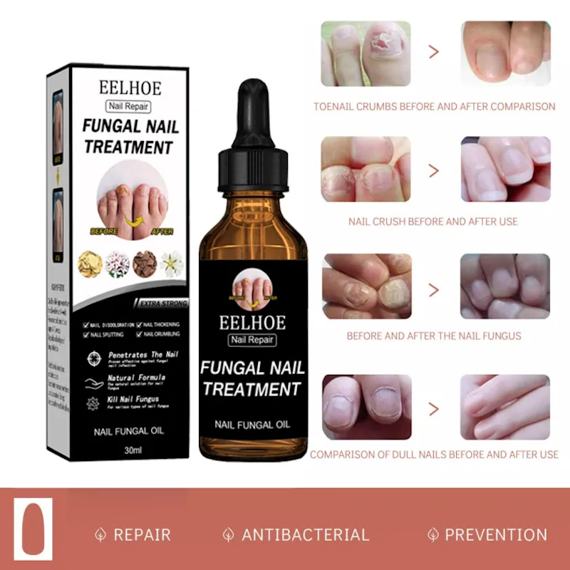Fungal Nail Treatment 2
