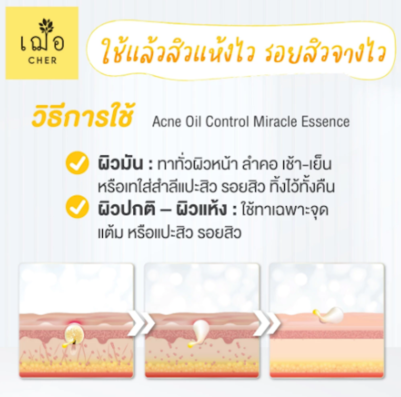 Acne Oil Control Miracle Essence Oil Free 3
