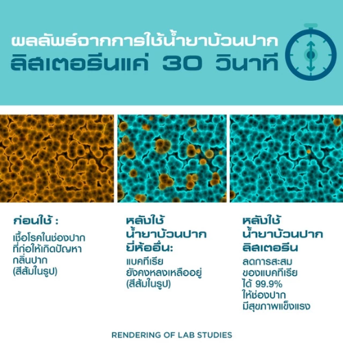น้ำยาบ้วนปาก Total Care Zero 3
