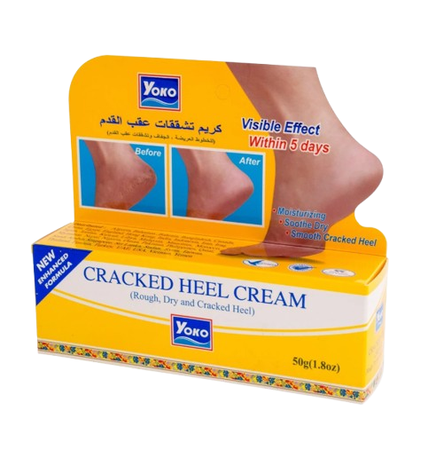 Cracked Heel Cream
