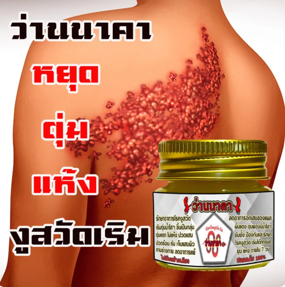 ว่านนาคา 3