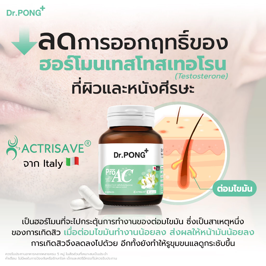 อาหารเสริมดูแลเรื่องสิว ProAC 3