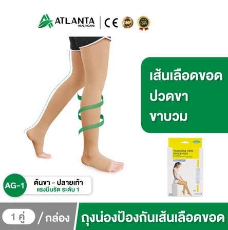 ถุงน่องเส้นเลือดขอด ระดับ 1   4