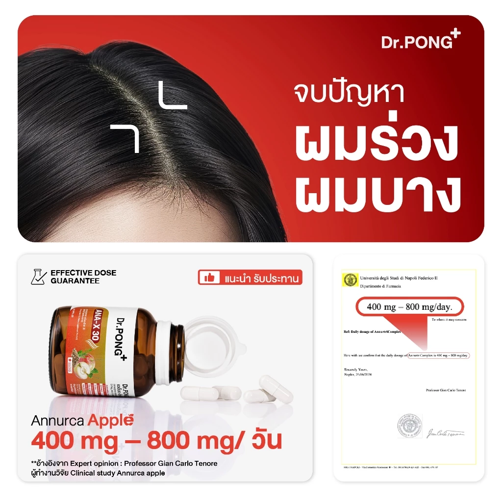  อาหารเสริมยืดวงจรเส้นผม ANA-X 30 2