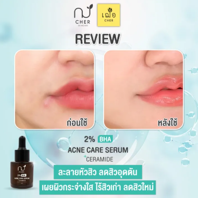 Acne Care Serum + Ceramide 3