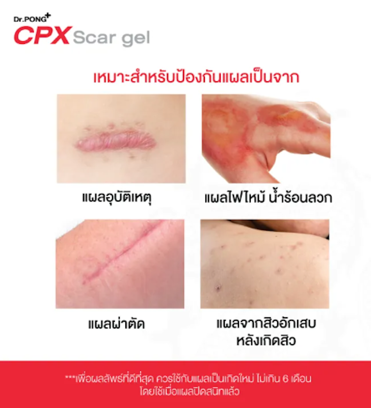 CPX Scar gel 2