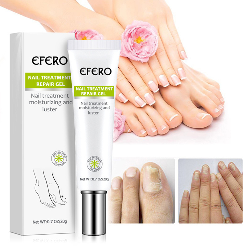 Onychomycosis Nail Repair Essence Cream 3