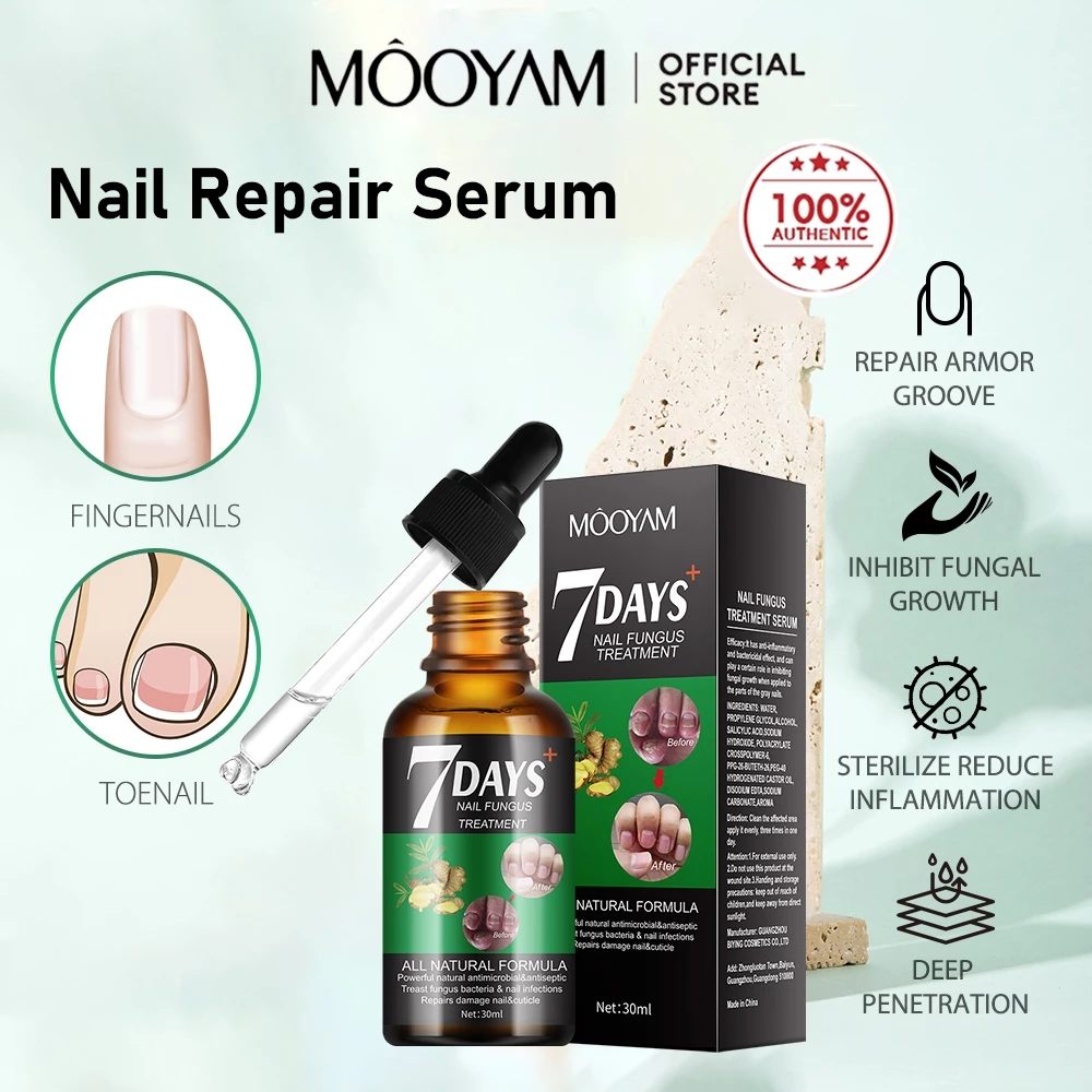 7 Days Nail Fungus Treatment 2
