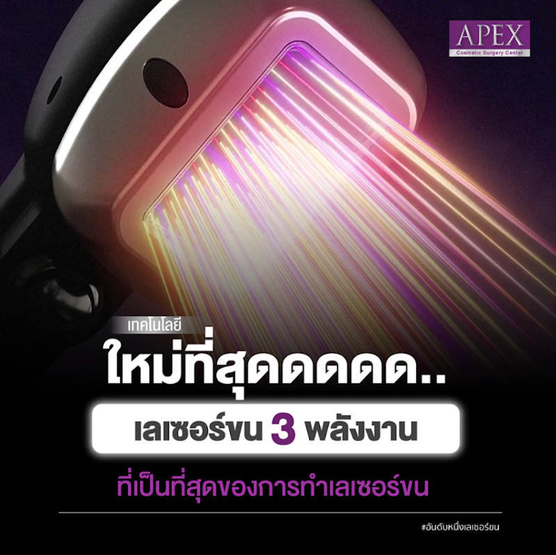เลเซอร์กำจัดขน กำจัดขนรักแร้ โปรพิเศษ 10 ครั้ง/1 ปี 3