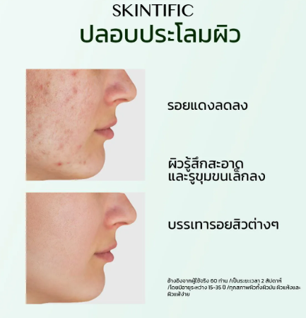 Mugwort Acne Clay Mask Stick 3