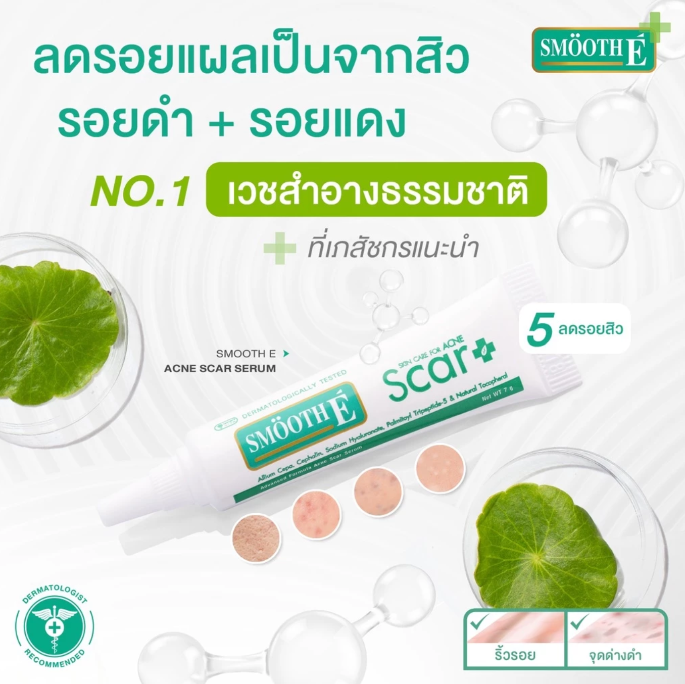 เซรั่มลดรอยแผลเป็น Acne Scar Serum 2