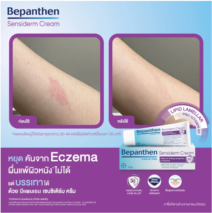 Sensiderm Cream ครีมบรรเทาอาการคัน 2
