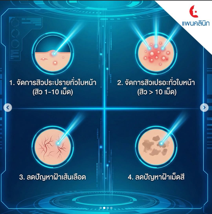 คลินิกรักษาสิว 2