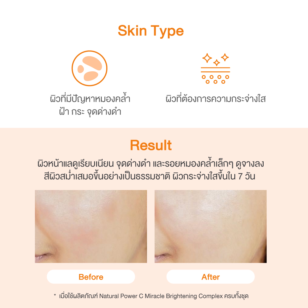 Natural Power C Miracle Brightening Complex Power Boosting Serum 3