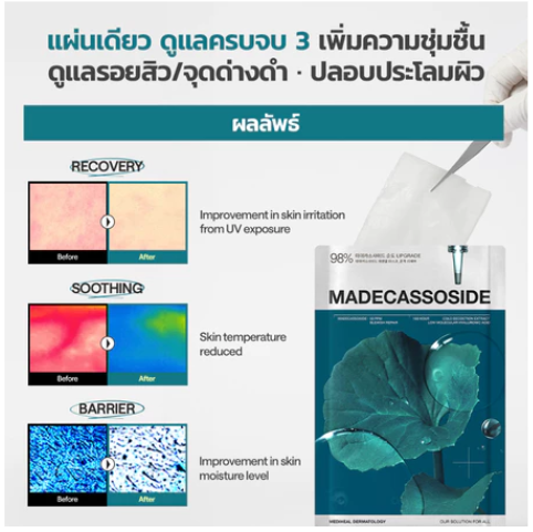Madecassoside Blemish Repair Essential Mask 2