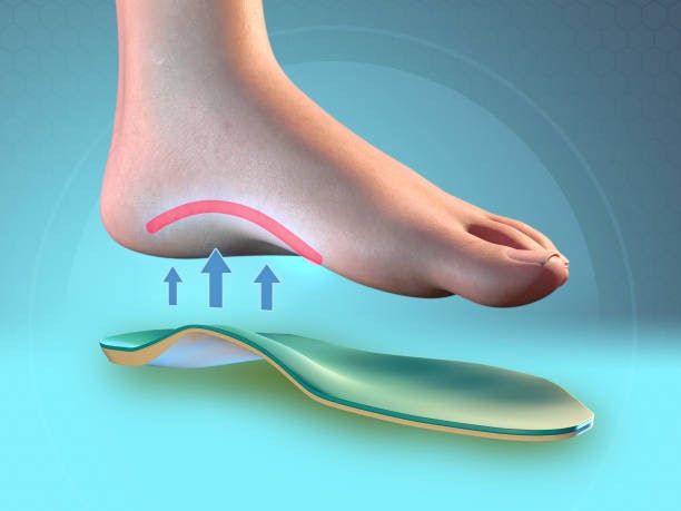 เลือกรองเท้าแก้รองช้ำที่มีเทคโนโลยี Arch Support บริเวณพื้นรองเท้า