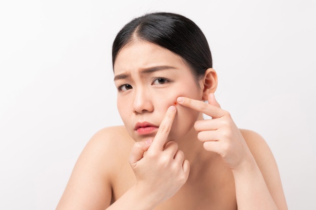 มองหาสูตรที่มี Zinc เพื่อลดปัญหาสิว