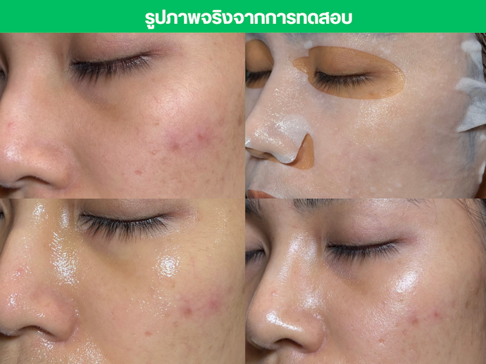 แผ่นมาส์กหน้า BANOBAGI DX Mask White & Young
