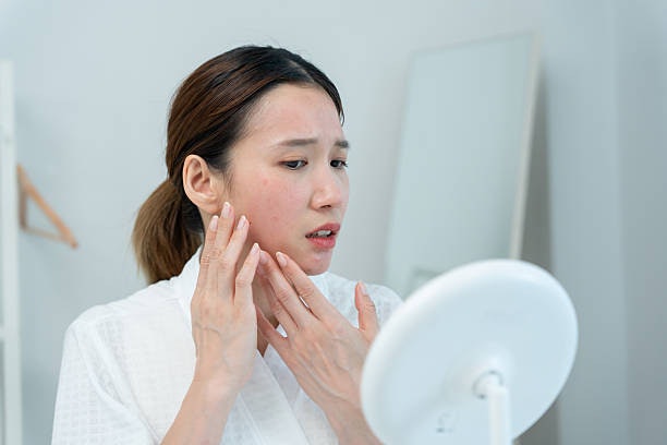 ตรวจสอบราคา โปรโมชั่น และเงื่อนไขการกดสิวก่อนเข้ารับบริการ