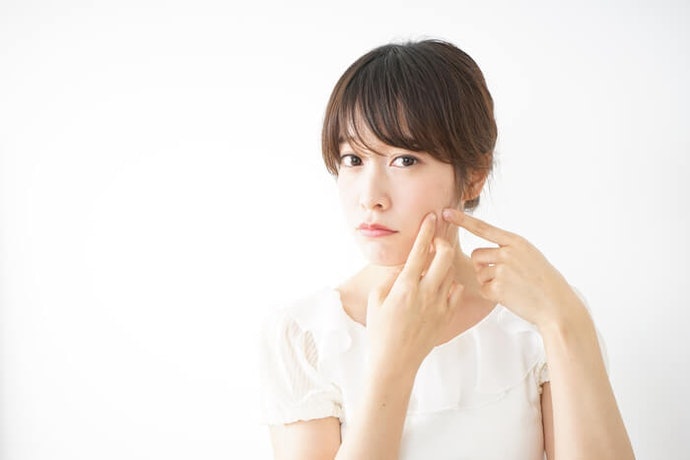 สำหรับคนเป็นสิวให้มองหาส่วนผสมของสารป้องกันการเกิดสิว