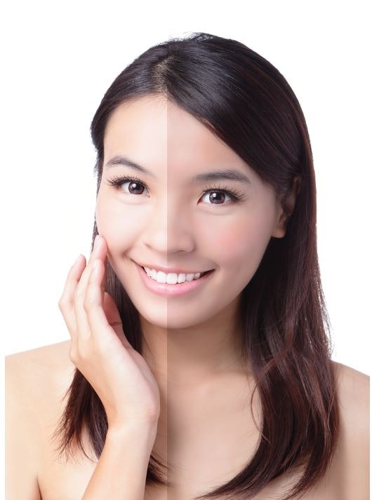ไม่จำเป็นต้องซื้อสูตร Whitening