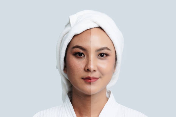 ปัญหาผิวหมองคล้ำ มีจุดด่างดำ เลือกโฟมล้างหน้าเกาหลีที่มีส่วนผสมผลัดเซลล์ผิว