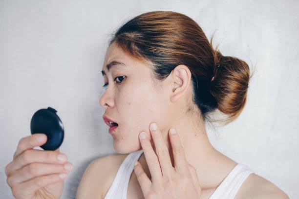 สำหรับคนผิวมัน เลือกโฟมล้างหน้าเกาหลีสูตรคุมมัน หรือ Oil-Free
