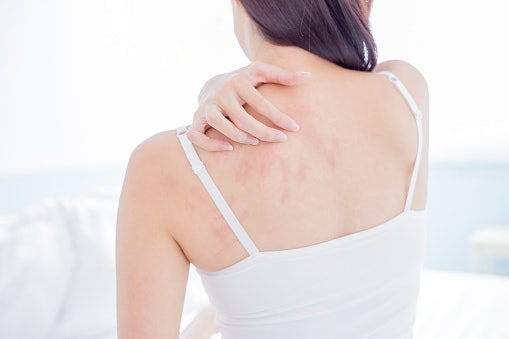 โลชั่น Aveeno สำหรับผิวแห้งมากและแพ้ง่าย