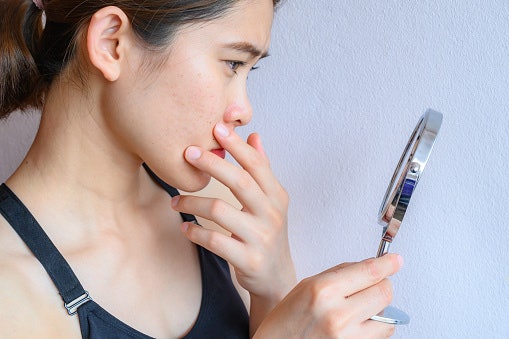 Collagen สำหรับผู้ที่มีปัญหาเรื่องริ้วรอย