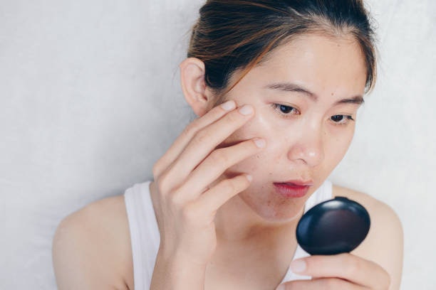 ผิวมัน แนะนำโฟมล้างหน้าญี่ปุ่นที่มีส่วนผสมช่วยควบคุมความมัน