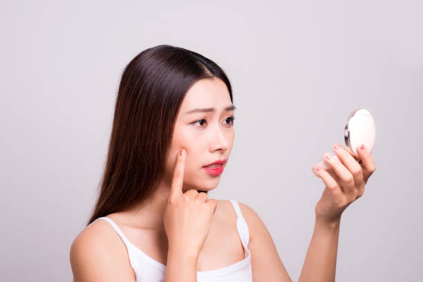 คนเป็นสิว เลือกแป้งพัฟสูตร Non-comedogenic หรือสูตรสิวโดยเฉพาะ